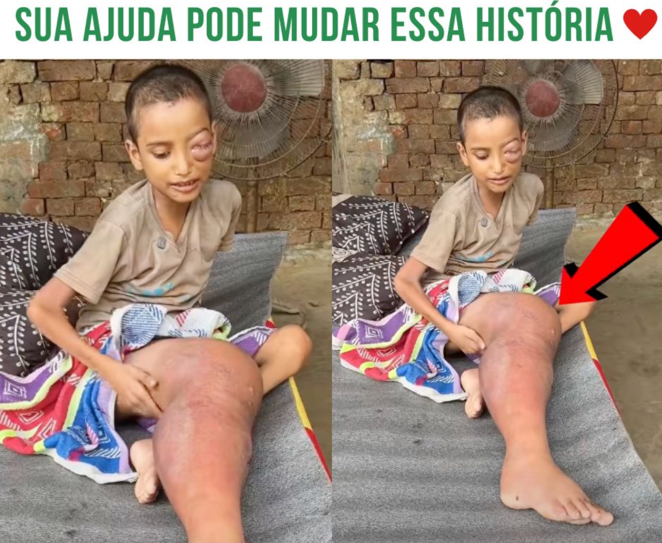 Maitê